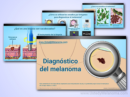 Acceda a presentaciones de diapositivas visualmente informativas sobre el melanoma.
